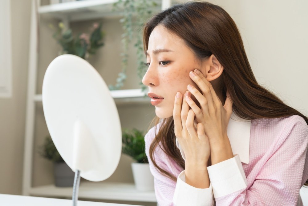 Como Combater Melasma e Manchas na Pele: Soluções Eficazes para Uma Pele Uniforme e Iluminada